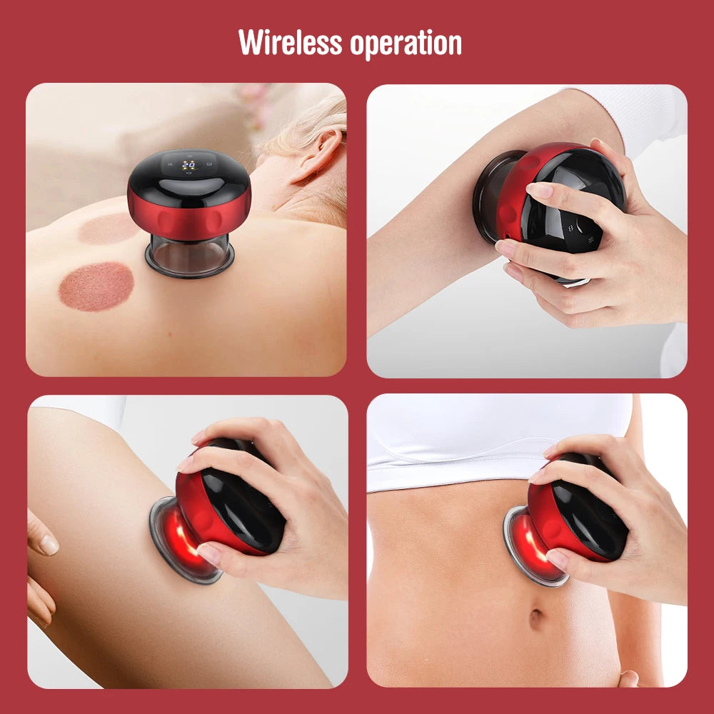 VacuoTherm Smart Electric Cupping Massager